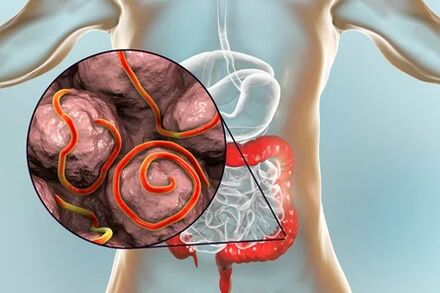 Parásitos no intestino