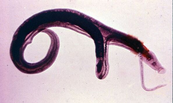 Os esquistosomas están entre os parasitos máis comúns e perigosos