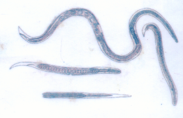 Pódese infectar facilmente co verme de Guinea, que parasita baixo a pel